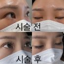 삼도골고루 | 의정부 속눈썹, 의정부 속눈썹 연장, LED연장 &#34;개화 아이래쉬&#34;