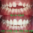 유니치과기공소 네이버블로그