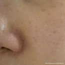 화잘먹필링으로 유명한 더메디닥터카렌듈라필링젤 후기