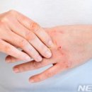옴 이미지