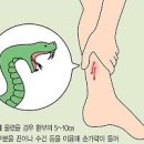 뱀에물렸을때 응급처치 및 쇼크증상 이미지