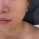 현직미용과 교수가 운영하는 성남피부관리 라움셀뷰티랩, 두피+피부 1STEP 환골탈태