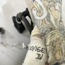 웰키즈아동병원 | 아기 혈변 구토 장중첩증 시술 후기