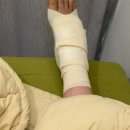 두리옥 왕 갈비탕 | [일상] 5월 5주차: 발 재수술하고 누워만 있었던 ㅣ초밥ㅣ맥날ㅣ염증제거ㅣ공차ㅣ군체영화후기
