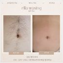 아이스왁싱
