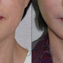 강남미의원 이미지