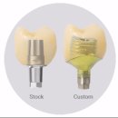 우리치과기공소 이미지