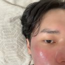 부산 사하구 하단 알레르기 -MAST 검사 후기 | 스파휘게 트로이필