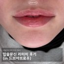 중원-56 | 입술문신 리터치 후기 (in 드브아브로우) 당일