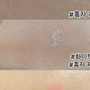 써니메디칼 이미지