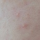 오일스팟 이미지