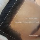 메움스칼프