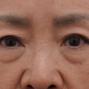 고유성형외과의원 네이버블로그