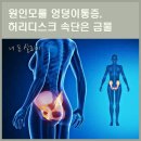 엉덩이통증 이미지