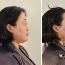 뷰티작업실 | 오창윤곽 관리 추천_비대칭 고민 해결한 뷰티작업실 후기