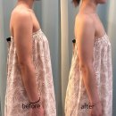 광리1 | 광주 수완지구 “365 메디스킨” 팔뚝 관리, 웨딩관리 후기