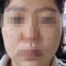 능곡예인의원 이미지