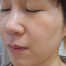 대광썬에너지(주) | [내돈내산] 기미제거 도미나크림 / 클렌즈주스(이틀 3kg 감량) / 아오라 레일블럭