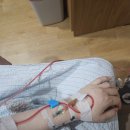 CS목장 | 경산모 제왕절개 3일차 신생아 황달 갑자기 강남 세브란스 NICU 전원