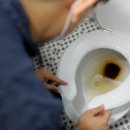 (주)메디퓨처 | 통증 없는 혈변 20대, 설마.. 나도 암?
