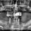 연세청천세브란스치과의원 이미지
