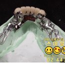 스마일기공소 이미지