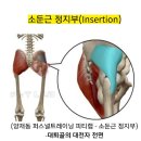 생크와 오른발바닥, 드라이버 풀스윙 이미지