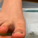 타임네일 페디베네 네이버블로그