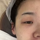 [부천 에스테틱] 스무살에머물다 l 물광촉촉 깐달걀 피부되기
