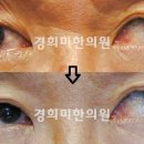 경희미한의원 네이버블로그