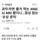 과자·라면 즐겨 먹는 4060, 뇌 MRI 봤더니…증상 없는 ‘손상 흔적’ 이미지