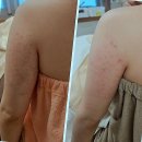 양덕동254 | 숨겨왔던 나의 피부와 바디 고민, 이제 끝낼 시간! 양덕동피부관리