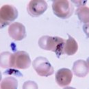말라리아 및 원인과 검사 백신 (약) : 모기 지역 전염 이미지