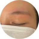 리르뷰티 | 당진 잔흔제거 잘하는곳 '리르뷰티'에서 붉은눈썹 잔흔제거후기