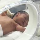 울산우리안약국 | 신생아 귀 접힘 교정후기 - 울산대학교병원 강병철 교수 ‘해피 뉴 이어’