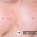 빵긋홈케어 네이버블로그