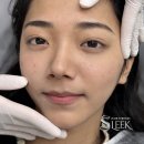 하나엘케이 | 청담역눈썹문신 고민 끝! 엘케이뷰티엑시스 강남본점 눈썹문신 반영구수강에서 만족한 후기