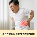 탑신경외과재활의학과의원 | 소래포구 월곶포구 오이도 신경외과 추간판탈출증 증상과 예방법