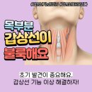 대구 갑상선 항진증 병의원 안내