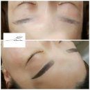 엘메디컬센터 네이버블로그