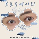 에이치브로