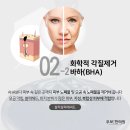 우보분당
