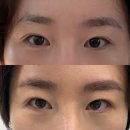 뷰티솔루션 | 강북미아 브로우펌 32샵뷰티에듀솔루션 브로우펌 후기