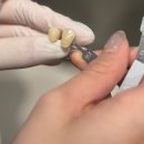 이바른치과기공소 이미지