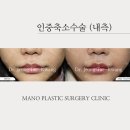 인중