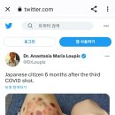 일본 시민, 백신 3차 접종 6개월 후 다리 모습 이미지