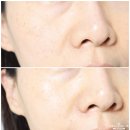 (유)우리환경 | 안티에이징 크림 추천 유담화 유산균 크림으로 완성한 물먹크림으로 피부장벽 케어하기