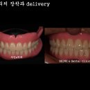 샤인치과기공소 네이버블로그