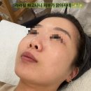 2619 | [리뷰] 대전 봉명동 피부관리 모공좁히는 법