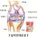 축구선수 전십자인대 수술전후 재활운동 이미지